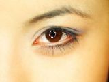 Asian Double Eyelid at ~4mm; DST, double eyelid surgery, natural
